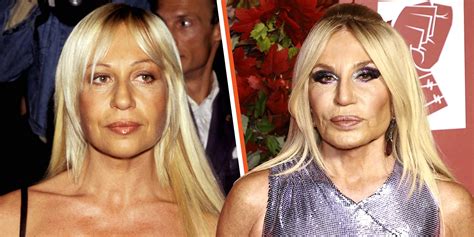 donatella versace real look|donatella versace before plastic surgery.